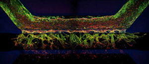 Drug Discovery