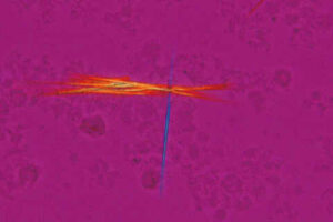 Gout Testing