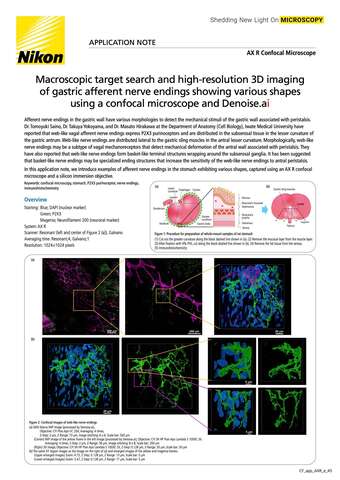 Tìm mục tiêu macro và chụp ảnh 3D độ phân giải cao các đầu dây thần kinh dạ dày với hình dạng đa dạng bằng kính hiển vi confocal và Denoise.ai