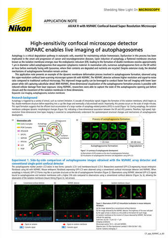 2405E High sensitivity confocal microscope detector NSPARC enables live imaging of autophagosomes b043d2b295ef57929ca14a8b6cb20560 1