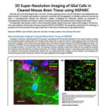 3D Super-Resolution Imaging of Glial Cells in Cleared Mouse Brain Tissue using NSPARC