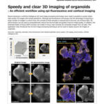 Chụp ảnh 3D nhanh và rõ nét của cơ quan mô phỏng (organoids)