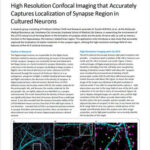 Chụp ảnh confocal độ phân giải cao giúp xác định chính xác vùng khớp thần kinh trong tế bào thần kinh nuôi