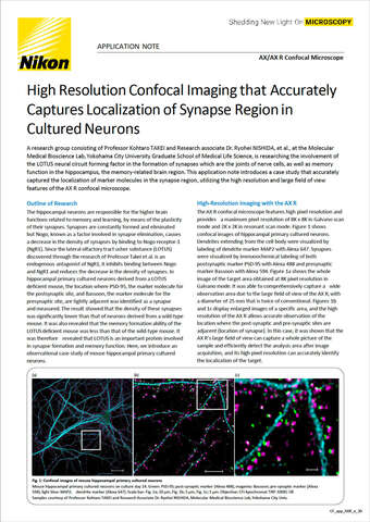 CF app AXR e 0517 CapturesLocalizationofSynapseRegioninCulturedNeurons b043d2b295ef57929ca14a8b6cb20560