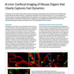 Chụp ảnh confocal in vivo các cơ quan chuột rõ nét động học nhanh