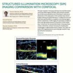 Structured Illumination Microscopy (SIM) Imaging Comparison with Confocal