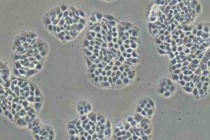 Tissue Culture