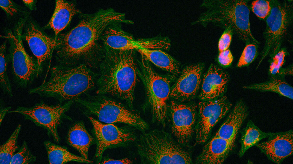 Hình ảnh tế bào HeLa: Nhân tế bào (DAPI), Tubulin (FITC), Ty thể (Mito Tracker RedFM), thu được bằng mẫu chuẩn Nikon.