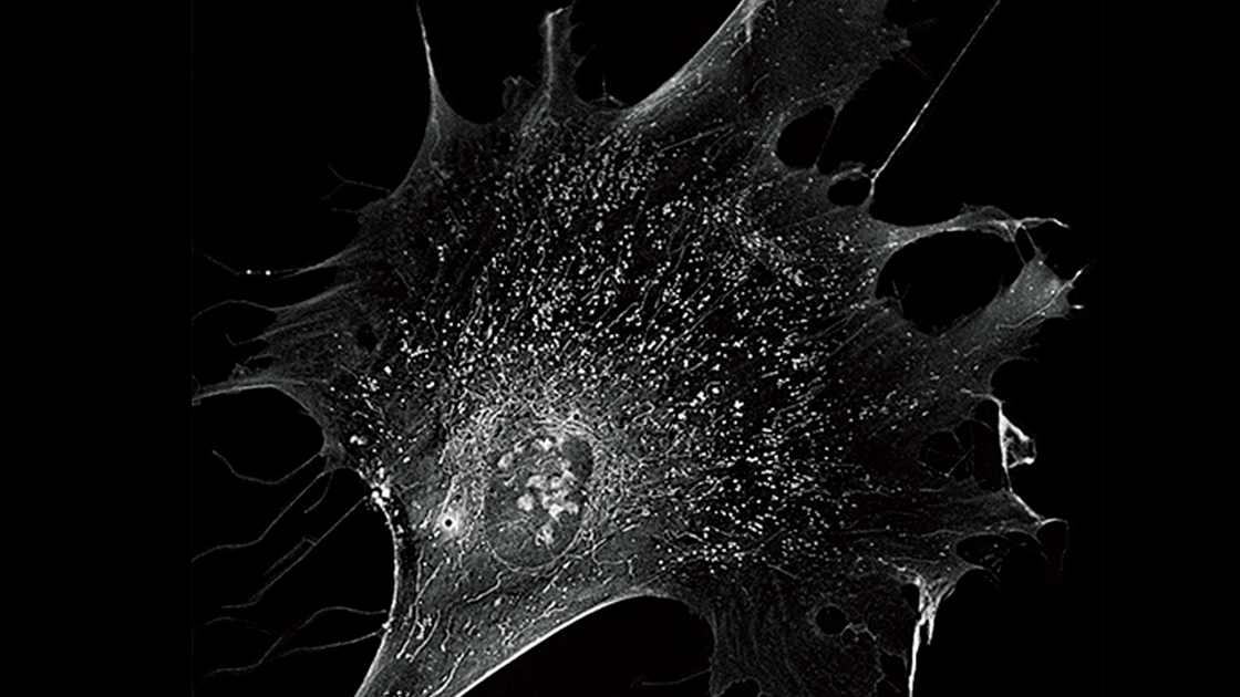 Hình ảnh 3d độ phân giải cao - công nghệ Holotomography