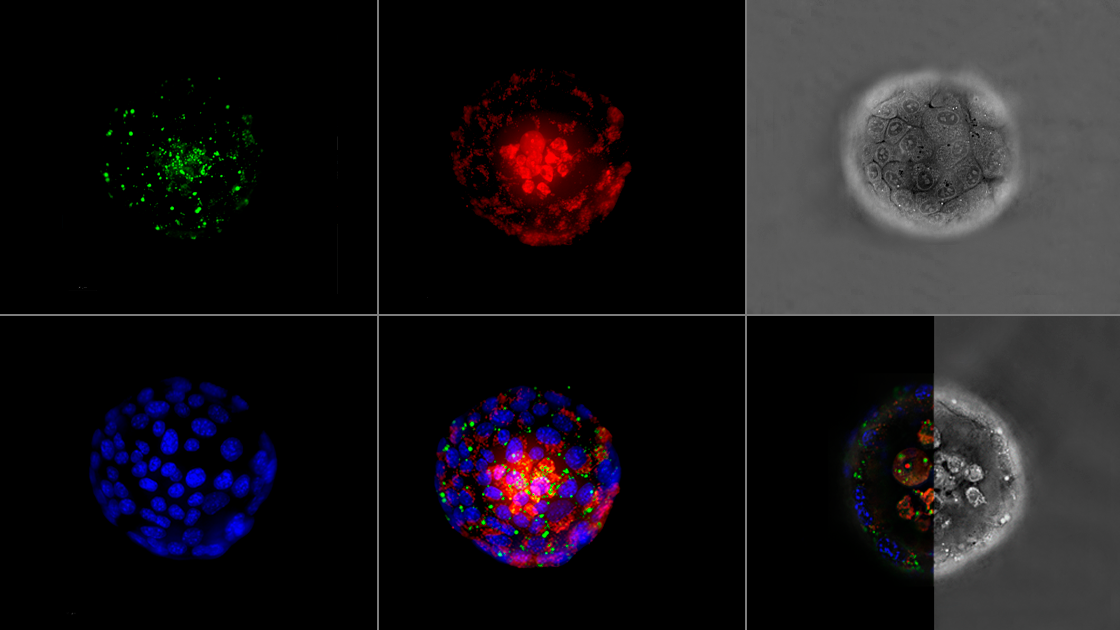 Hình ảnh huỳnh quang tương quan nâng cao -Holotomography